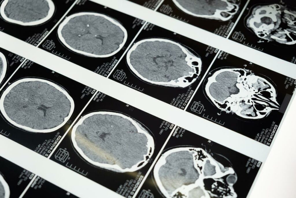 Free MRI Images of the Brain Stock Photo